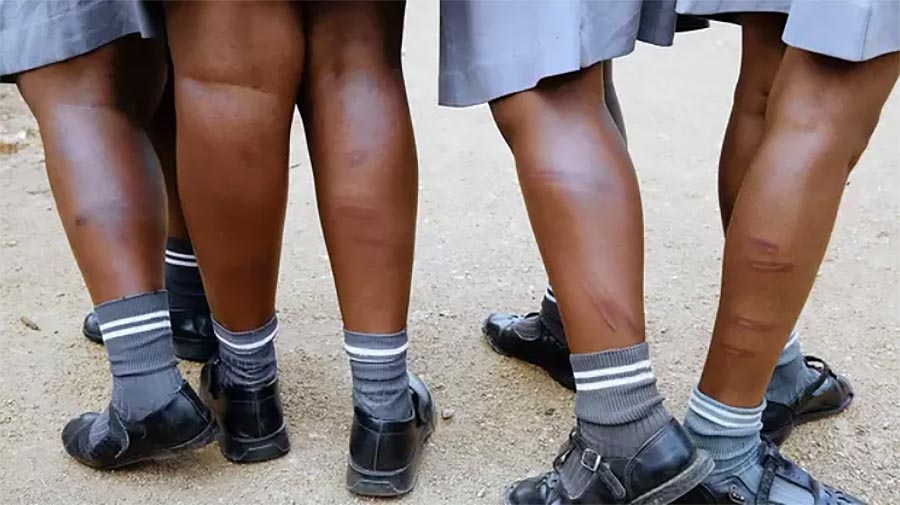 lose-up of several schoolchildren’s lower legs in uniform socks and black shoes, showing visible bruises and welts on their calves.